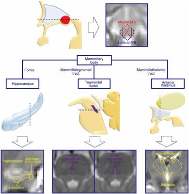 Dissociable Networks of the Lateral/Medial Mammillary Body in the Human Brain